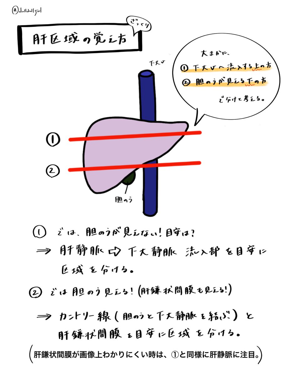 【#だるがメモ】
ややこしい肝区域の覚え方!

ざっくりだけど、画像上で区域を見分けるポイントを分かりやすく教えてもらったので忘れないようにメモっとく!! 