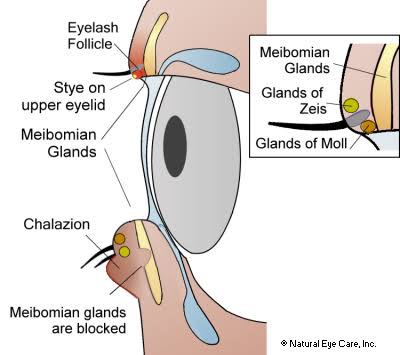 MedicalMnemonik's tweet photo. Topic: Ocular anatomy 

Subtopic: Glands of the eyelids

Clue: Write out MZMW, then 

Add “ei” and “ol” - 
Mei, Zei, Mol, Wol – 

#Meibomian, #Zeis, #Moll and #Wolfring https://t.co/IR2OyWW9As