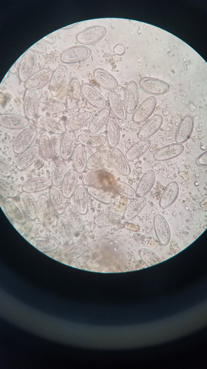 lab_phot's tweet photo. What do you see...?! 

1. Adult worm... 
2.Egg...?! https://t.co/F77f8iLzY5