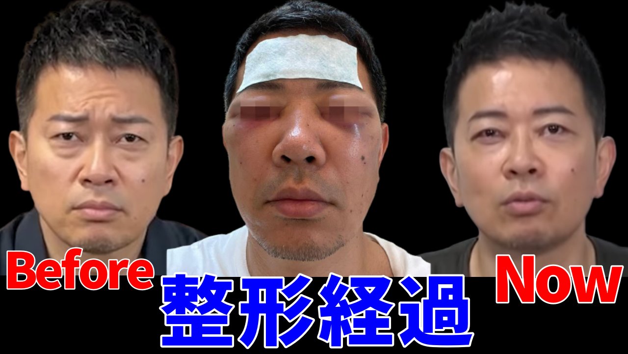 宮迫博之のショートトーク 切り抜き ちゃんねる 宮迫さん整形途中経過 続きはこちら T Co Dap2ky2tnw 宮迫 整形 宮迫博之 T Co Bsq4bu99tn Twitter