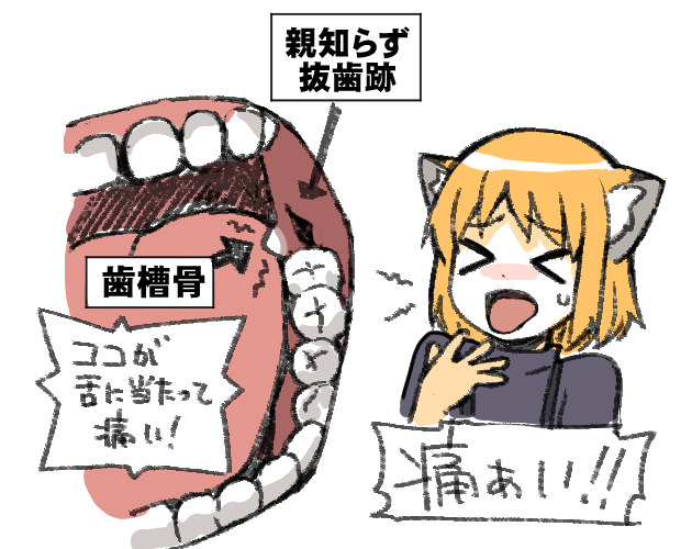 親知らず抜歯のtwitterイラスト検索結果 親知らず抜歯のtwitterイラスト検索結果