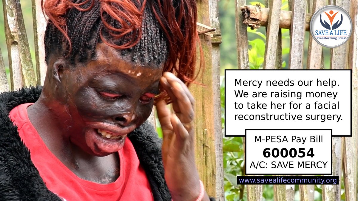 Ghetto_good's tweet photo. @missme5__ #SaveMercy
Pay Bill:600054
Acc. No:SaveMercy
+254 722 214 817 https://t.co/MV8LRZv7yh