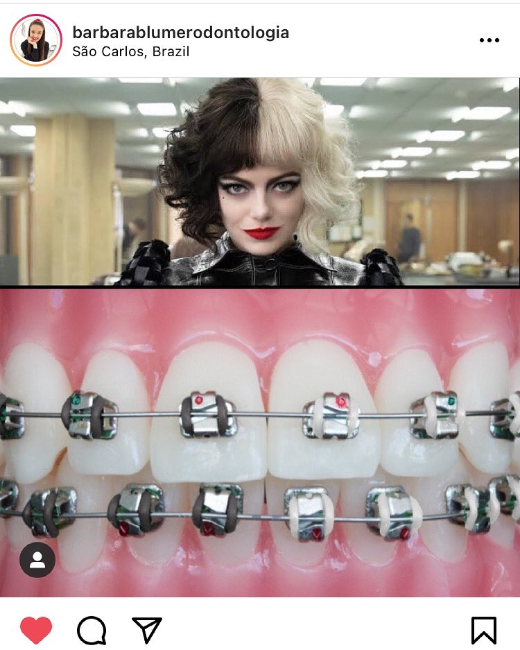#cruella #cruelladevil #ortodontia #ortodontista #101dalmatians #disney #aparelhoortodontico #aparelhoortodôntico #aparelhodentario #aparelho #odontologia #odontología #braces #orthodontics #ortho #orto