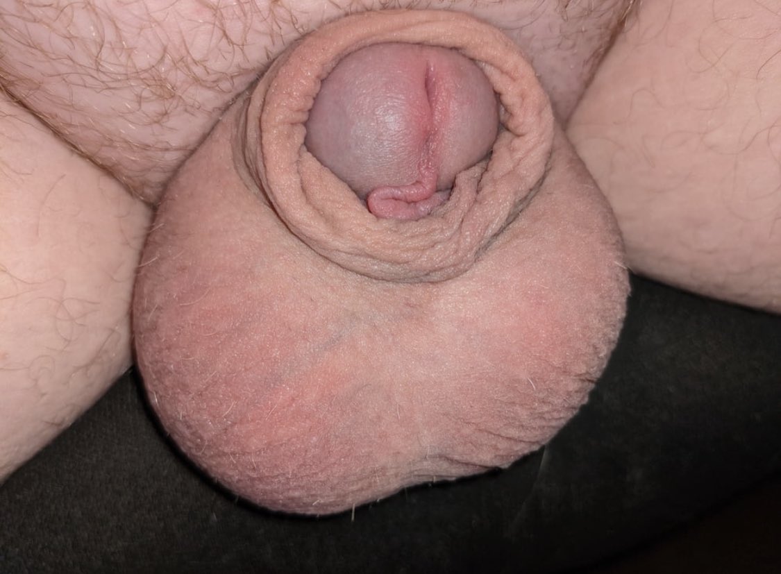 Minipene2's tweet photo. Clit with balls #minicazzo #schiavo #minicazzo #smalldick #smallcockpride #smallcocksrock https://t.co/6dgADeRGwS