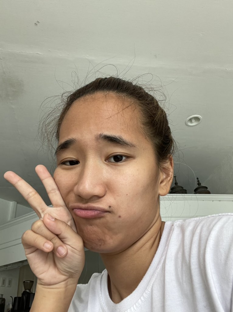 patlasaten's tweet photo. Gudafternun mga mamsir di na ako nagayos pero gusto ko sumali hehehe hello na lang sa pimple ko 🥴 

#LiwanagSelcaDay https://t.co/yi3wLXsUWa
