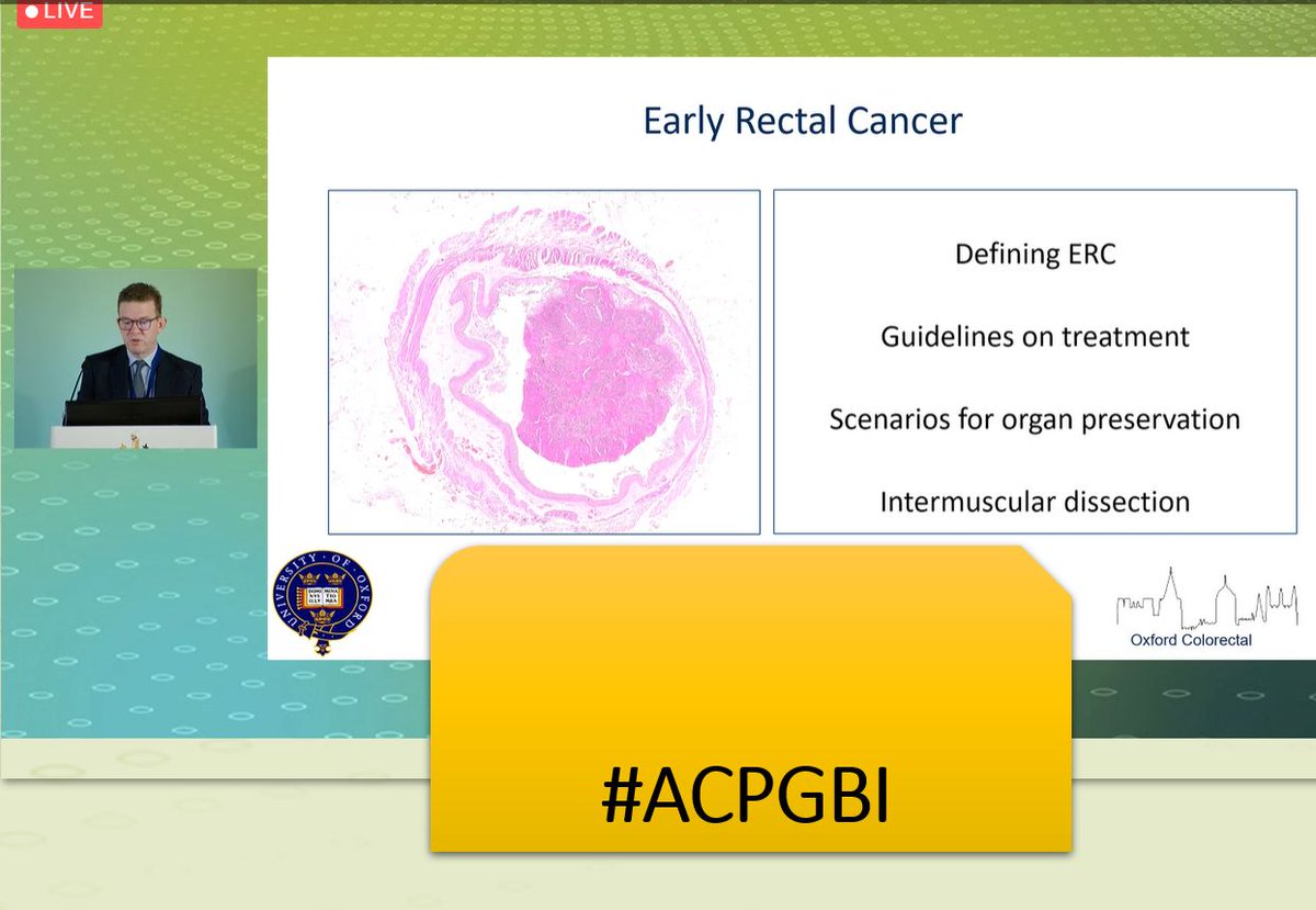 Woaww!!! #ACPGBI2021 @ACPGBI first session with Laura Hancock @MissLHancock  and Jared Torkington @TorkiJ chairs for #colorectalfocus pls join in to enjoy the #colorectalsurgery science and gather ideas for #colorectalresearch @CBizzle1 @panchali_sarmah @debby_keller @RCS_RADAR