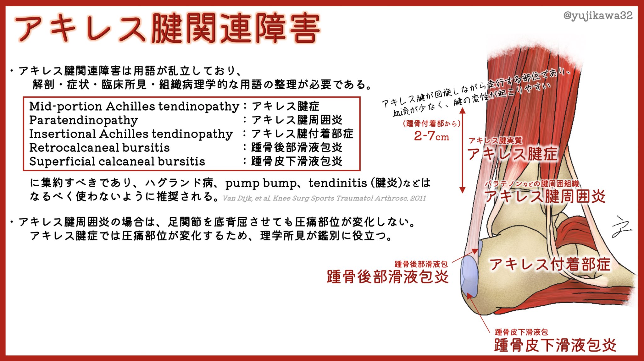 ユジカワ 整形dr イラストレーター アキレス腱関連障害の用語の使い分けを図示しました 似たような言葉がたくさんあるので要注意 僕自身 右だけアキレス腱周囲炎で苦しめられています アキレス腱 イラスト日記 アキレス腱関連障害 T Co