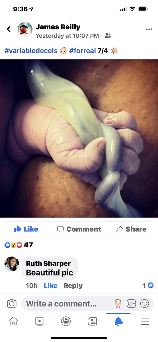 jgpr21's tweet photo. #littlehand👶🏻#umbilicalcord https://t.co/qgIVtSyARV