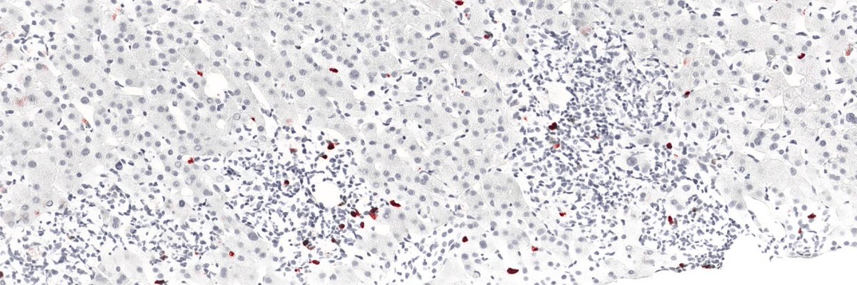 Science Immunology tweet media