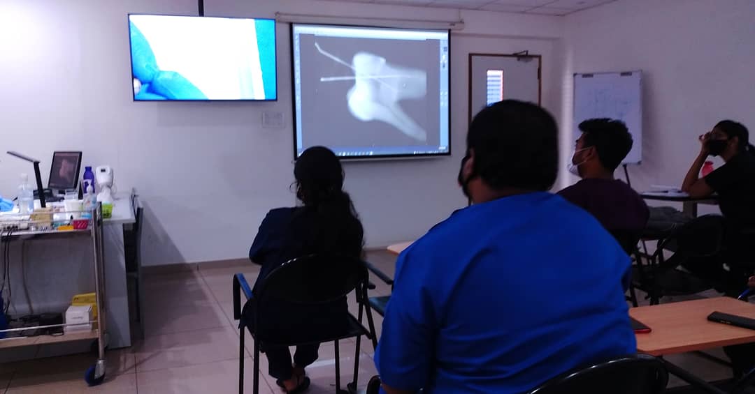 AAEINDIA's tweet image. 6 Week Of Advanced Clinical Endodontic Program Started On 1st Of July 2021 ... 

Today  discussion on Internal Anatomy and Access Opening ... 

#aaeindia #aae #aaeskillprogram #aaeian