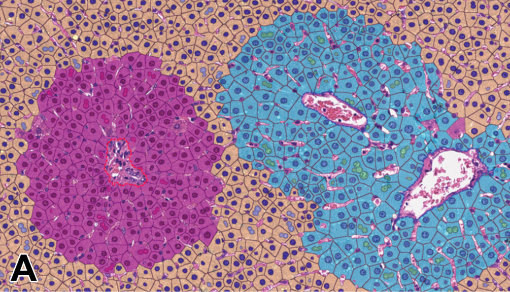 KeaneToxPath's tweet photo. #artificialintelligence has huge potential in science. Here's a new podcast from Toxicologic Pathology by @SAGE_Publishing  (official journal of STP, ESTP, &amp; BSTP) by Pischon https://t.co/NE4tyIUDQZ. (49:4) on how this can transform our discipline. Enjoy. https://t.co/8poHdyHkXn https://t.co/aQQjVqo6FM