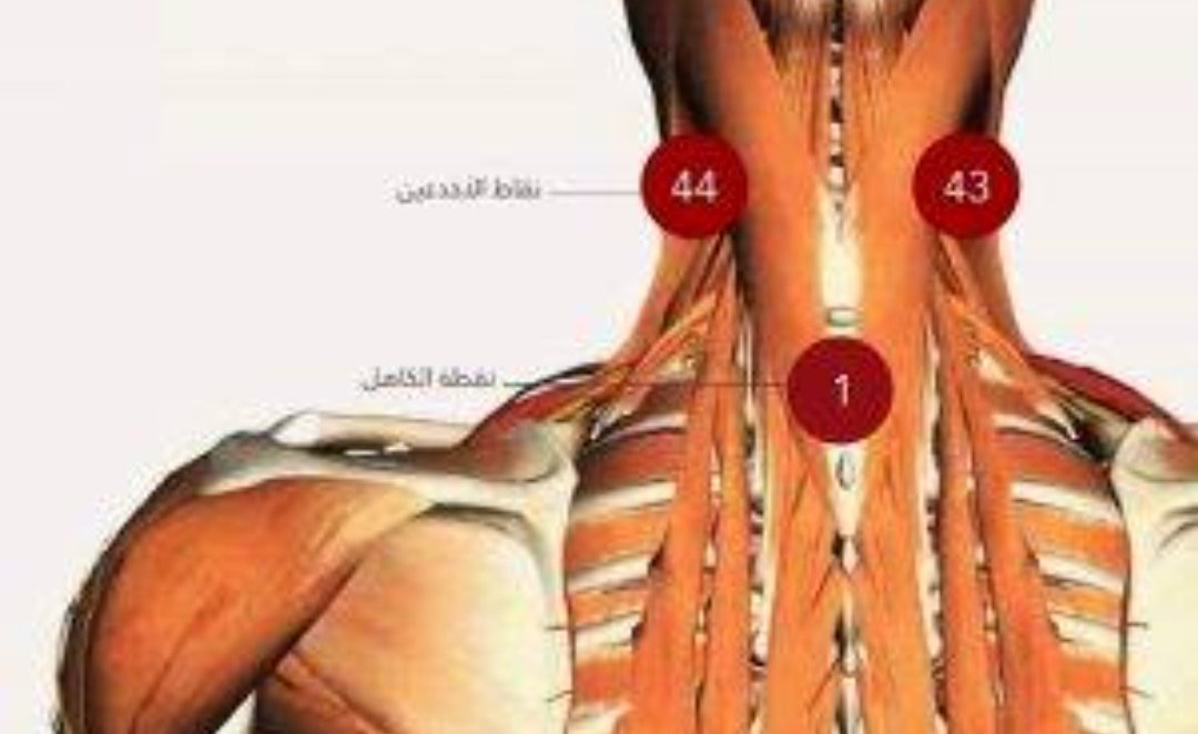 Funlearn13's tweet image. #غيمة_وابل
#امطري٤ 
((كان رسولُ اللهِ صلَّى اللهُ عليهِ وسلَّم يَحْتَجِمُ في الأَخْدَعَيْنِ والكاهِلِ))