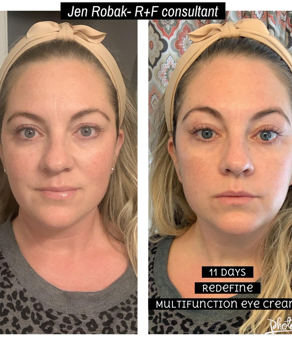 monikalovesjay's tweet image. This is our newly reformulated magnificently brilliant Multi Function  Eye Cream in action for you!! 
😍✨Best✨Eye✨Cream✨Ever✨😍 

#rodanandfields #multifunctioneyecream #liftandfirm #lovetheskinyourein #glowwithmonika