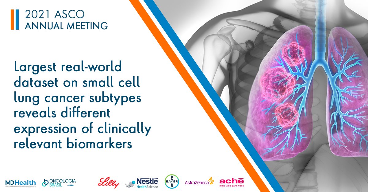 Differential expression of immune genes and predictive biomarkers in SCLC subtypes may indicate therapeutic targets for personalized treatment approaches. The analysis represents the largest real-world dataset evaluated by whole transcriptome sequencing: bit.ly/3yuQJ7T