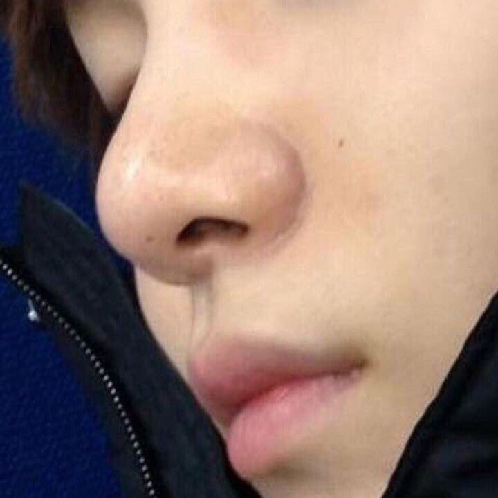 mygispace's tweet photo. abrindo um tópico muito delicado: narizinho do yoongi 🥺 https://t.co/xmVnH2gQW2