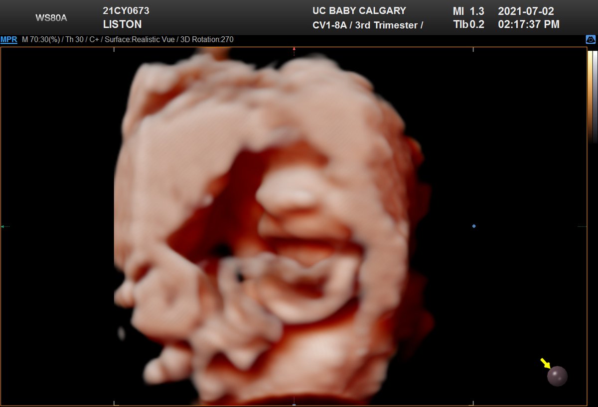 BdfJjl's tweet image. Somewhat unexpectedly, we appear to have created a Sith Lord. #ForceLightning #SheevRevealed #redlightsaber #redeyecoming #youdidthis #callitIan #throughahamdarkly