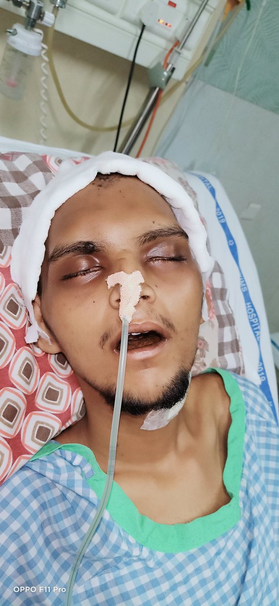 ARIFALI48584775's tweet photo. @MiyaHashmi Sir Black fungus Ka Brain ka surgery hua Daily 10 injections lagana hai
1 Month 1 injection ka cost 8000/-Rs hai Daily injections ka 80,000/- +Hospital other medicine Charges 50,000/-Total amt 130,000/-hora Save life sir 🙏🙏📱+918686648890 https://t.co/FpSj9uPWif https://t.co/AwC42exfZ0