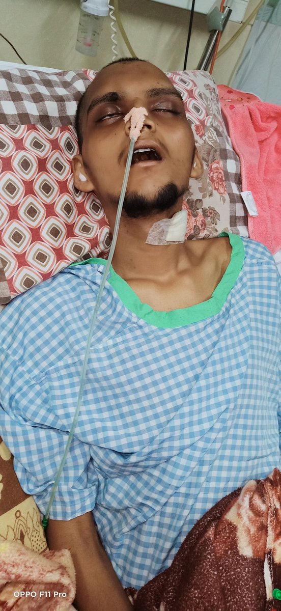 ARIFALI48584775's tweet photo. @MiyaHashmi Sir Black fungus Ka Brain ka surgery hua Daily 10 injections lagana hai
1 Month 1 injection ka cost 8000/-Rs hai Daily injections ka 80,000/- +Hospital other medicine Charges 50,000/-Total amt 130,000/-hora Save life sir 🙏🙏📱+918686648890 https://t.co/FpSj9uPWif https://t.co/AwC42exfZ0