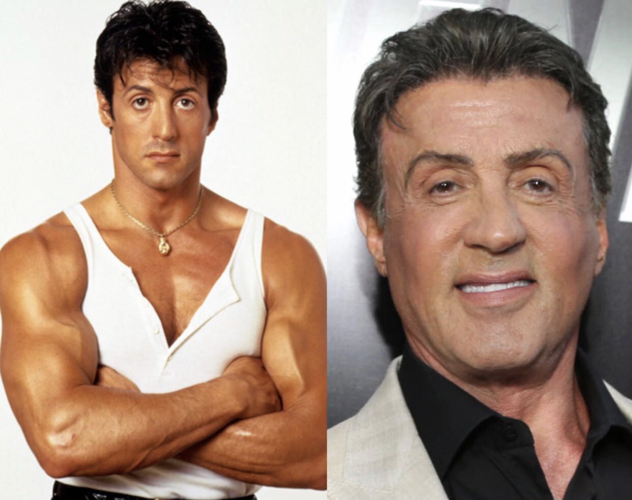 Sylvester Stallone Before And After Plastic Surgery