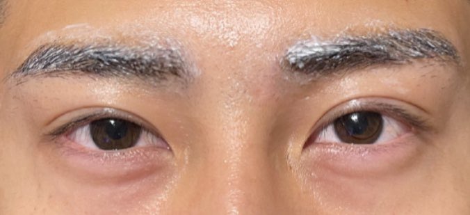 わたり ミクロゲンパスタ 眉 ラウンド髭