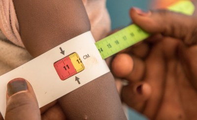 🇰🇪🌾 Uluslararası yardım kuruluşları tarafından paylaşılan raporlara göre en az 2 milyon #Kenyalı açlığın eşiğinde ve acilen #gıda yardımına ihtiyaç duyuyor.

#Kenya #starvation #malnutrition #açlık #gıda