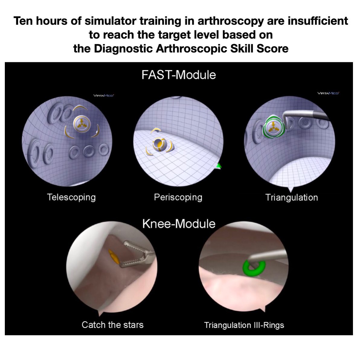 KSSTA's tweet image. This study showed that arthroscopic skills can be taught effectively on a simulator, but a 10-h course is not sufficient.
#Simulatortraining #Virtualarthroscopy #Arthroscopictraining #arthroscopicsurgery #orthopaedicsurgery #residenttraining 

Link: doi.org/10.1007/s00167…
