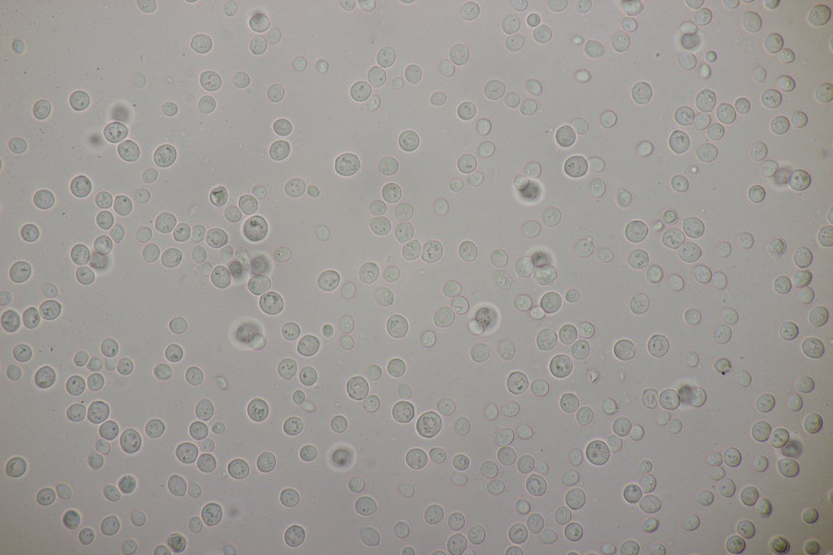 RPilze's tweet photo. Saccharomyces cerevisiae
#Saccharomycescerevisiae #Saccharomyces #Backhefe #yeast #Hefe #levure #levaduradecerveza #levadura #mushroom #mushrooms #fungus #fungi #pilz #pilze #champignons #champignon #nature #natur https://t.co/3QYWbqZIbC