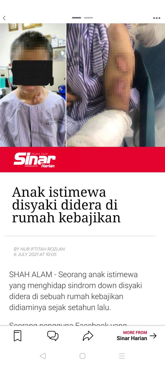 shamsiahali's tweet photo. Anak OKU didera. Apa dosa anak ini? Kenapa anak oku dibawah JKM diserahkan kepada NGO?@RinaMohdHarun tlg jwb!!! Almost 2 minggu sudah belum ada tangkapan yg dibuat. @PDRMsia kenapa masih tiada tangkapan?
Please retweet demi membela anak OKU ini 
#JusticeForBella https://t.co/En1aVcBWkN