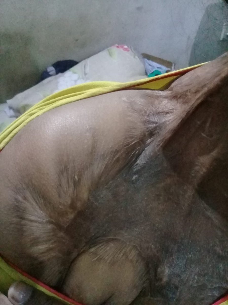 swakeey's tweet photo. Help Sandhya, an acid attack survivor, raise funds for her father’s treatment https://t.co/EATxumREik
@tehseenp https://t.co/qfPEeZpgKH