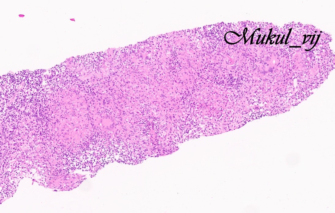 Mukul Vij, MD 🇮🇳 tweet media