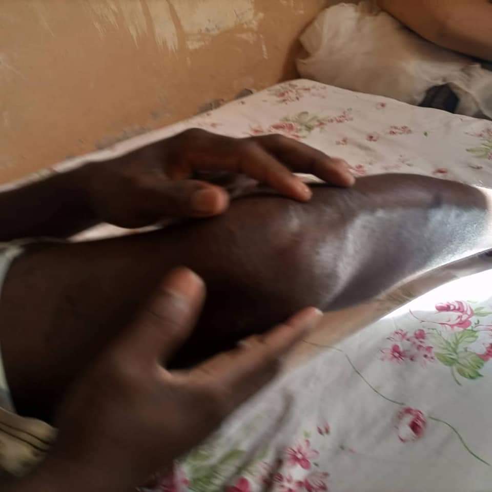 Wakiso_Yaffe's tweet photo. Matovu Denis 21yrs and Sonko Richard 25yrs were abducted on 8/12/2020.Were placed in water and stayed for a month. Soldiers used to cut their bodies, burning manhood. Were tortured for 8months.
2 Nights back they were dumped. 350+ @HEBobiwine 's supporters are still missing.😭 https://t.co/zViya2h1je