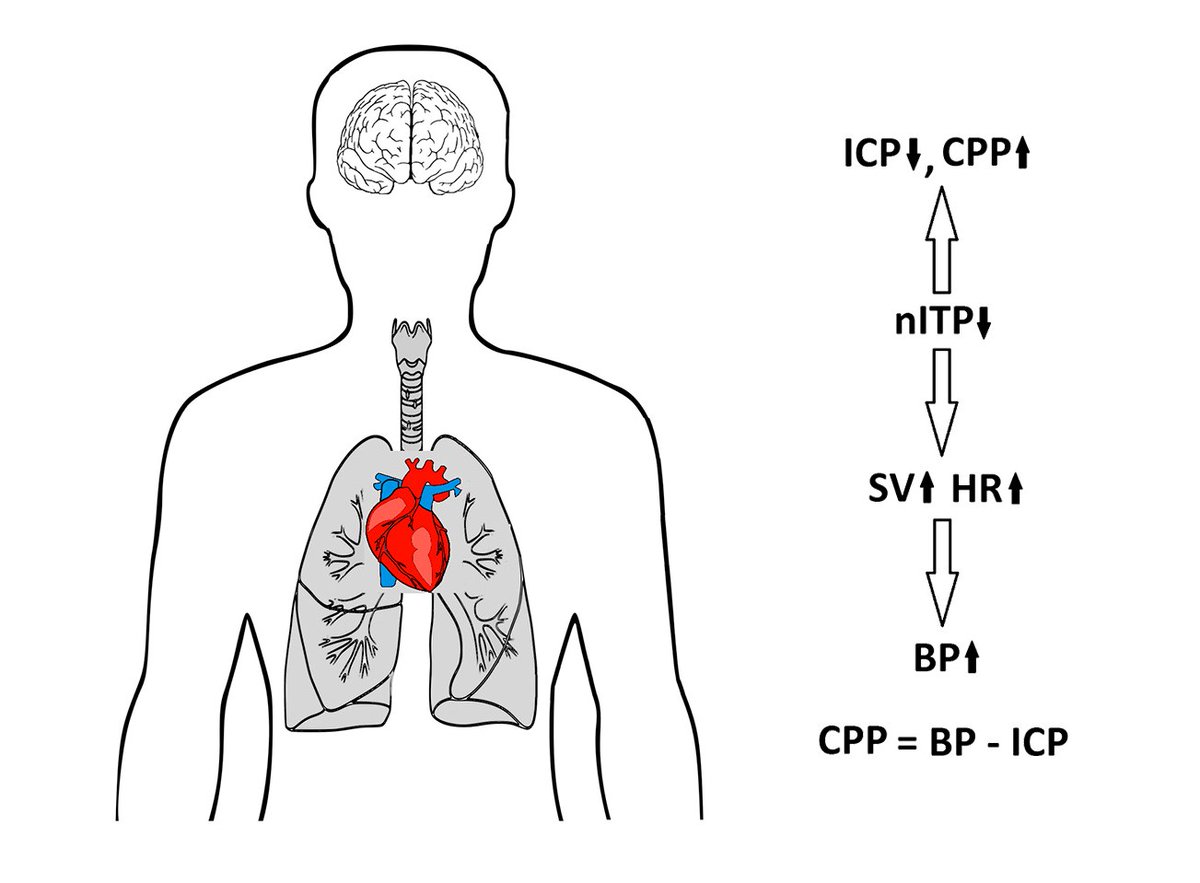 japplphysiol's tweet photo. #ImagesOfTheWeek: Current understanding of the effects of inspiratory resistance on the interactions between systemic blood pressure, cerebral perfusion, intracranial pressure, and cerebrospinal fluid dynamics” By: Pawel J. Winklewski, et al.
https://t.co/JdvPlFgFgZ https://t.co/tAchdjHATR