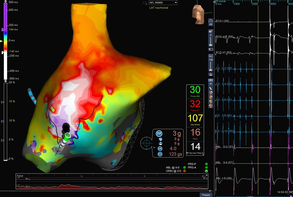 Mackenzie Willborn tweet media