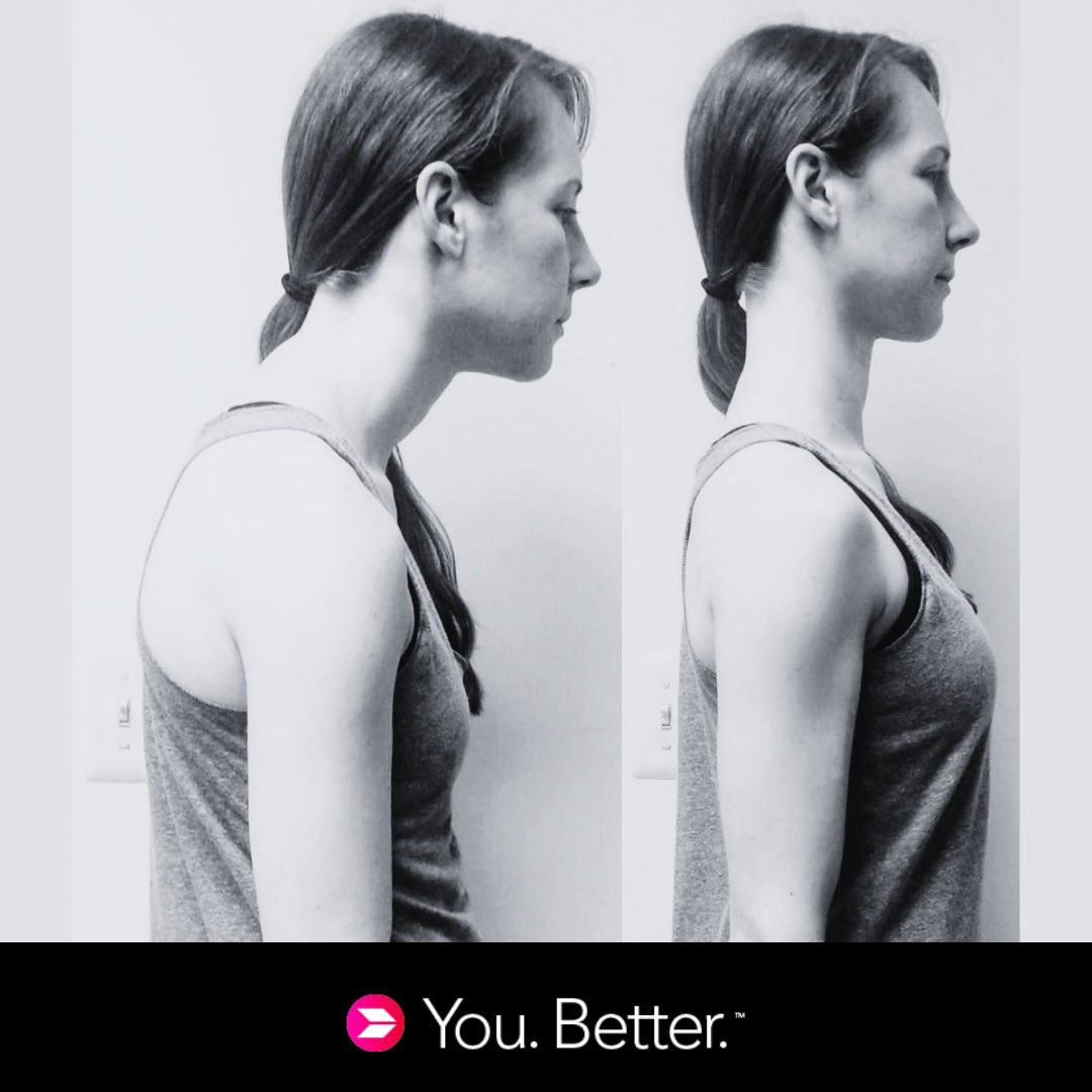 _Renew_Movement's tweet photo. ▪️With Upper Crossed Syndrome the back muscles of the neck and shoulders become overactive and strained. 
▪️The muscles in the front of the chest become shortened and tight.
▪️We help to loosen those muscles, leading to better posture and less pain! 
https://t.co/gmBGNs3RrM https://t.co/GhFP0XwhGt