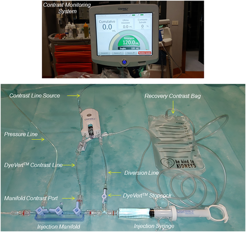 gbiondizoccai's tweet photo. "Contrast media volume reduction obtained by the DyeVert system is an effective strategy to prevent AKI in ACS patients undergoing invasive procedure"
https://t.co/cuuGTU1pJe
#DyeVert https://t.co/6zK3I4Ovmr