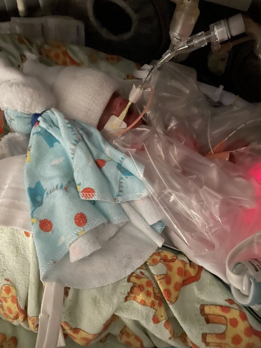 Renegade937OHIO's tweet image. My son Maverick was born this morning at 25 weeks tipping the scales at just 1lb 13oz. Emotional day, keeping the faith because God has plans for this boy. Thankful for the team of doctors in the NICU at Kettering &amp;amp; know he’ll receive the best care possible. Please pray for us.