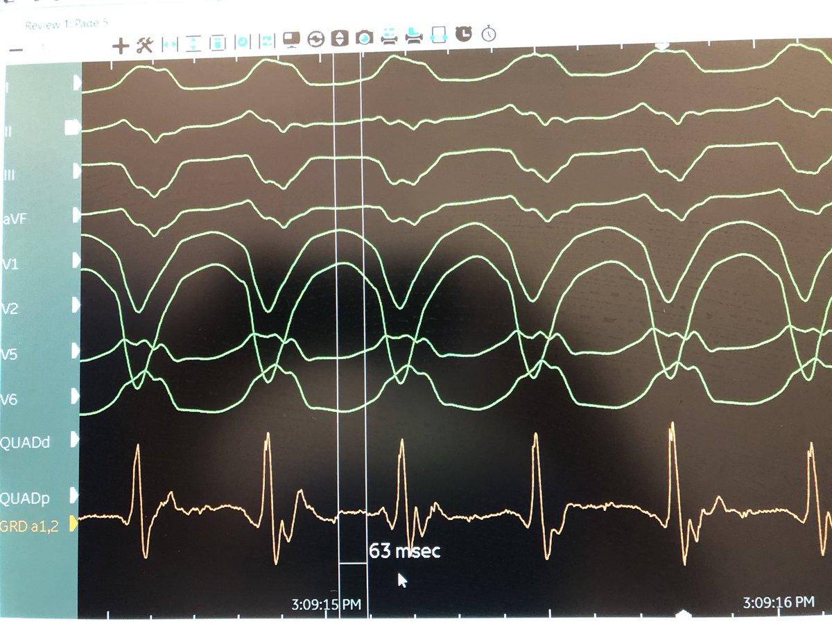 Vivek Iyer tweet media