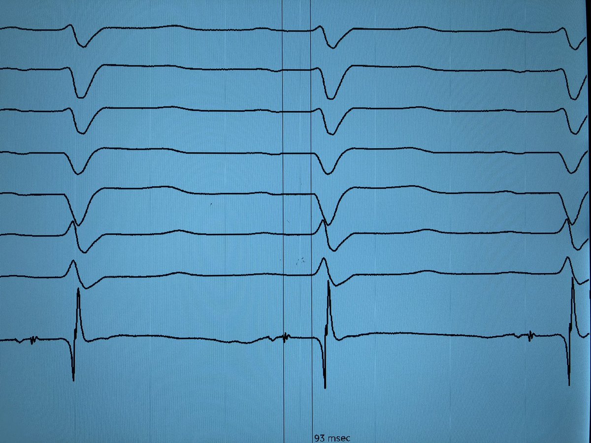 Vivek Iyer tweet media