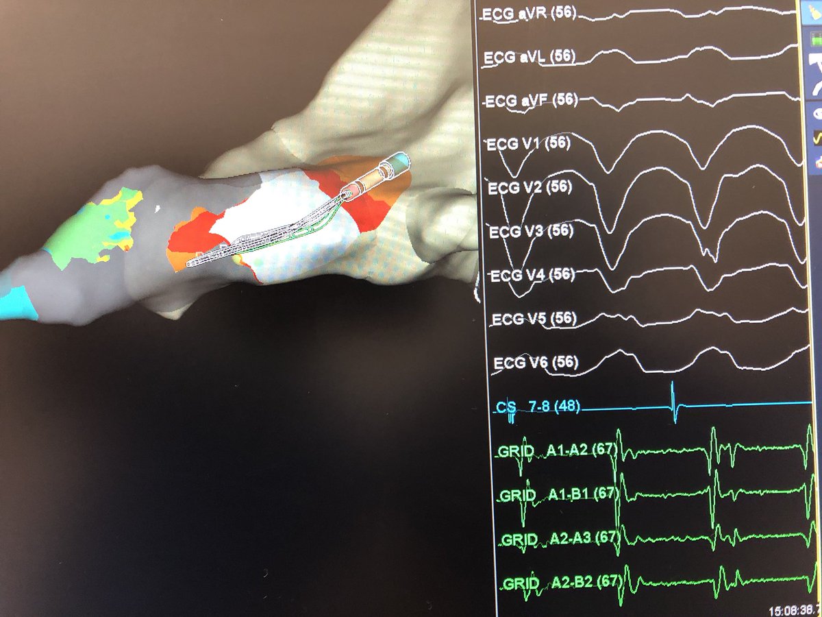 Vivek Iyer tweet media