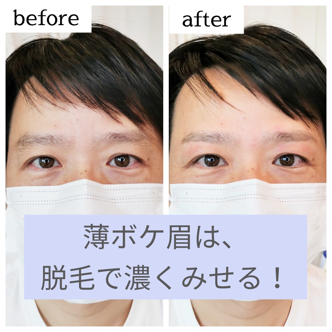 福岡 メンズ眉脱毛 メンズルーシー Menslucy Twitter