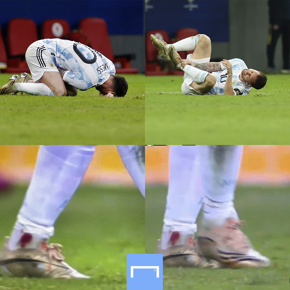 GOAL on Twitter "Lionel Messi's ankle has been bleeding after a