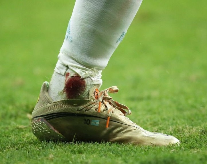 HoracioCabak's tweet image. #Messi