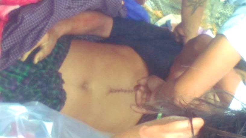 Ywa Thit Gyi, Hopin Township, Mohnyin

INNOCENT MAN KILLED FOR SPORT by SAC

U Ba Jam was returning from his farm with oxcart when he was set upon by 20 SAC troops &amp;  killed. Circa 8pm on 6 July.  

SAC removed bullets and returned his body. #WhatsHappeningInMyanmar