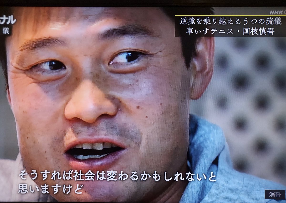 車いすテニス選手国枝慎吾氏 パラリンピックのテーマは 共生社会 だったりするけどそんなことのためにやってねえよって思っちゃうんですよ Togetter 車いすテニス選手国枝慎吾氏 パラリンピックのテーマは 共生社会 だったりするけどそんなことのためにやってねえよって思っちゃうんですよ Togetter
