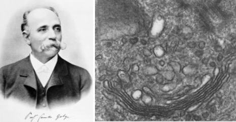 CellCultureCo's tweet photo. On this day in science history: Camillo Golgi - Born July 7th 1843.

Golgi published the use of silver nitrate to stain microscope slides. This allowed new details of cellular structure components to be revealed. His research earned him the Nobel Prize for Physiology or Medicine. https://t.co/D7NwmELhNK
