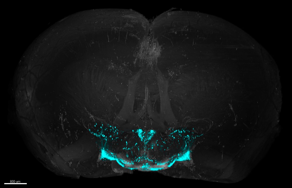 #SciencePhoto_IN
"Is this love?"
Author: Dra. Pilar Madrigal <a href="/pilarmadrigal_/">Pilar</a>
Lab: Dra. Sandra Jurado <a href="/LabSjurado/">SJurado_LAB</a> 
"3D reconstruction of oxytocin neurons located in the hipothalamus and adjacent regions in a mouse brain (frontal view)" #love #science #hypothalamus #oxytocin #3D"