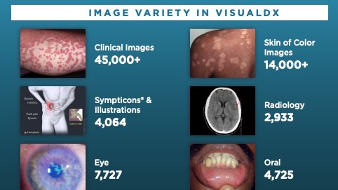 Looking to enhance realism in health care simulations? Try 
<a href="/VisualDx/">VisualDx</a>! 

This resource is available to all UNMC faculty, staff and students. 

Check out our new step-by-step guides to access and utilize realistic images:

bit.ly/2TB8t2F