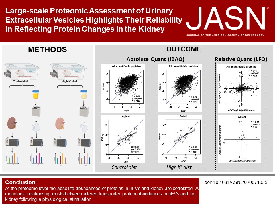 JASN_News (@jasn_news) on Twitter photo Urinary extracellular vesicles can be isolated from urine and are a stable source of proteins. This study found that proteomic analysis of uEVs in rats reliably reflects protein changes in the kidney bit.ly/j2020071035
@PAWellingMD <a href="/RickGrimmPhD/">Rick Grimm</a> <a href="/SathishKMurali/">Sathish Murali</a> <a href="/dhekidney/">David Ellison</a> Urinary extracellular vesicles can be isolated from urine and are a stable source of proteins. This study found that proteomic analysis of uEVs in rats reliably reflects protein changes in the kidney bit.ly/j2020071035
@PAWellingMD <a href="/RickGrimmPhD/">Rick Grimm</a> <a href="/SathishKMurali/">Sathish Murali</a> <a href="/dhekidney/">David Ellison</a>