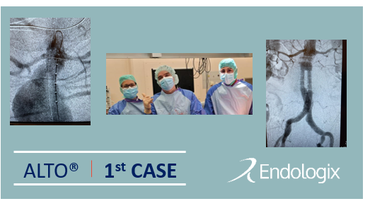 endologix's tweet photo. Congratulations on a great first ALTO case, Dr. Damiano Mugnai, university hospital Geneva. The case had a short hostile neck, which is often outside of the labelling for traditional EVAR repairs. #EVARevolved https://t.co/nb03qlceUn
