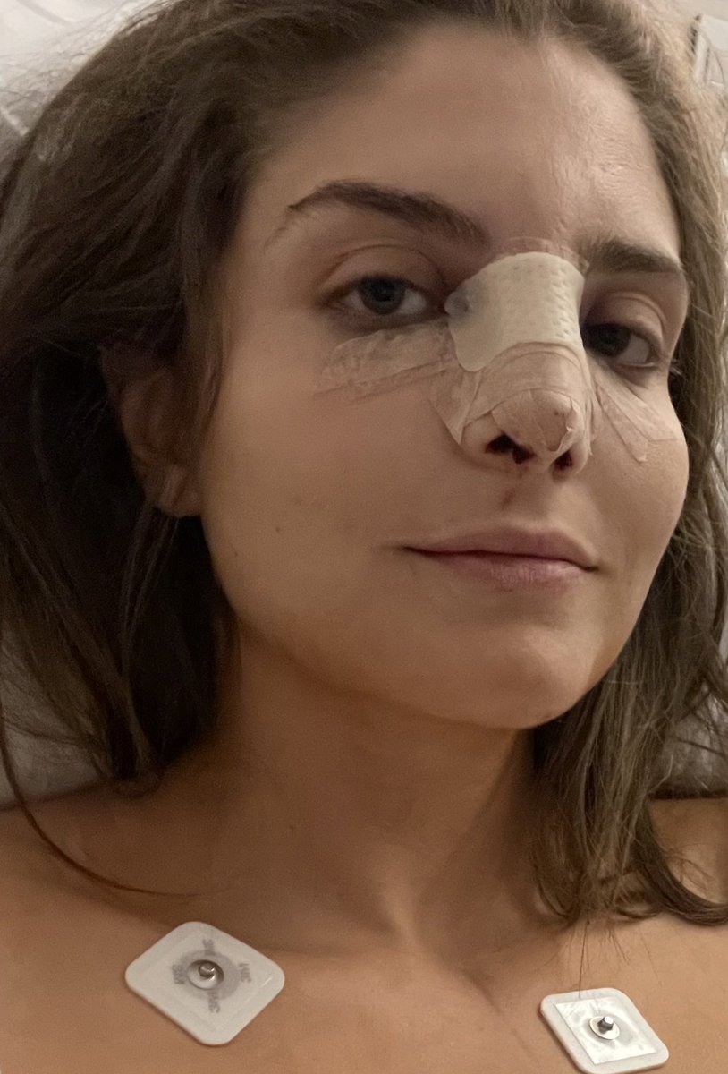 holasunshinee's tweet photo. Van 12 horas desde la operación y ya me desinflamé un buen. 
Me duele la garganta por la intubación pero no me duele naaaada nada nada la nariz y respiro mejor que antes aún toda inflamada, con mocos y sxngre 👌🏼 

Foto 1 12:30am foto 2 6am https://t.co/qAbs0KahTA